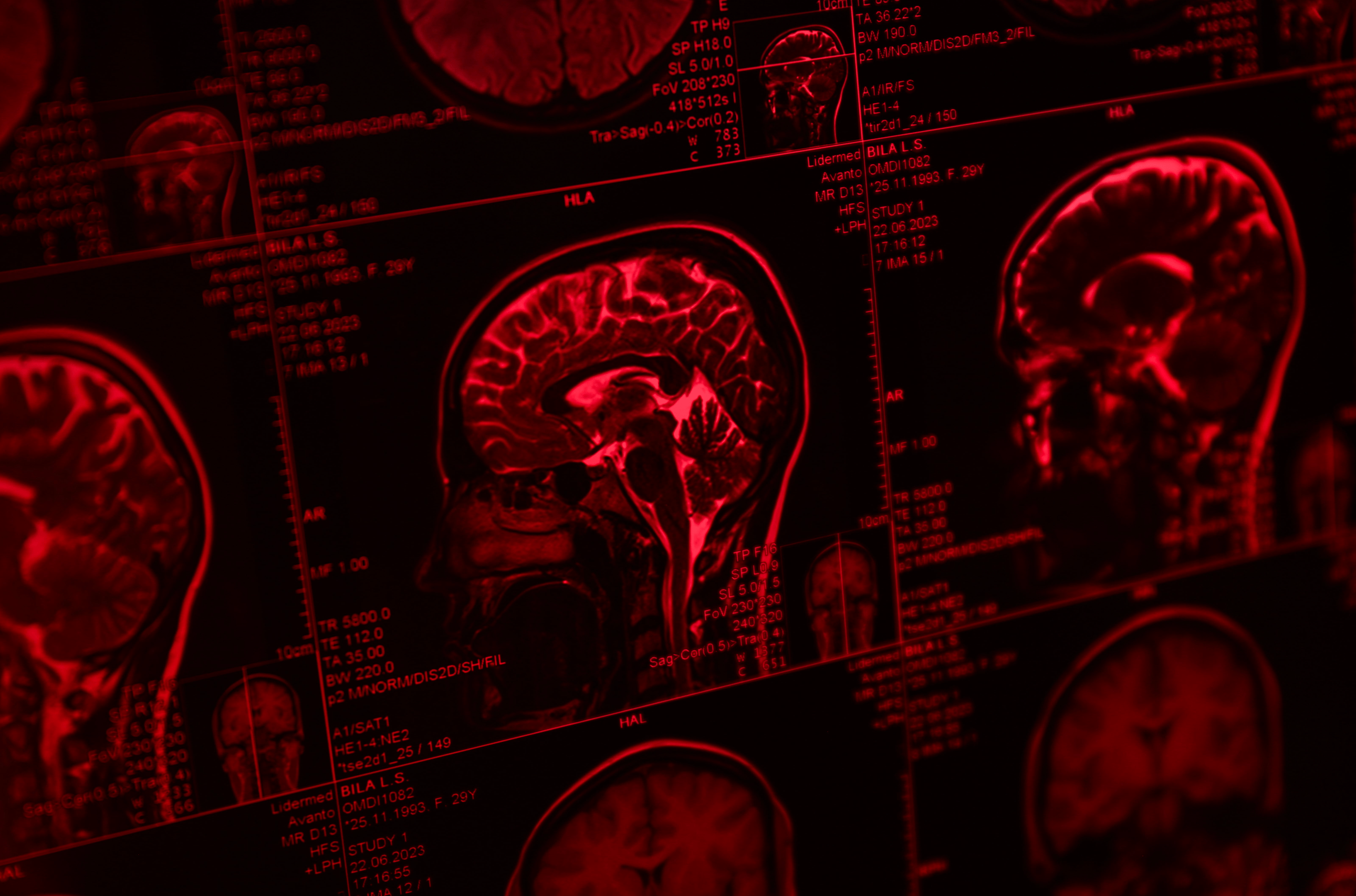 A Breakthrough for the Brain? The Surprising Link Between Red Light Therapy & Dementia