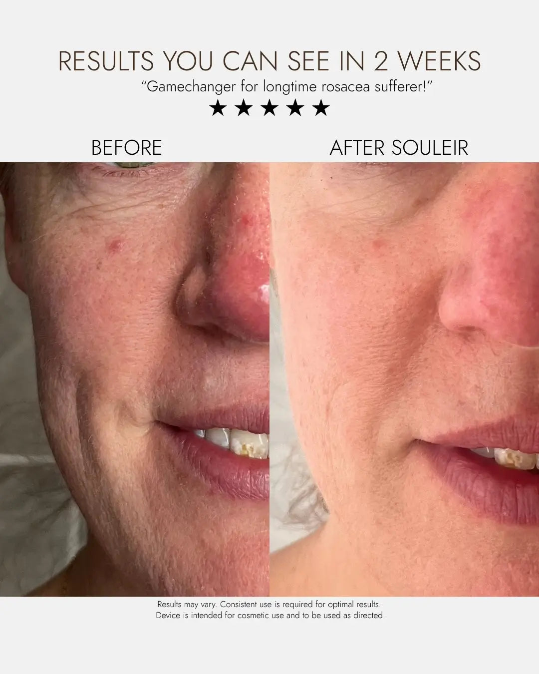 Ultimate Radiance Bundle: LED & Hydrating Serum