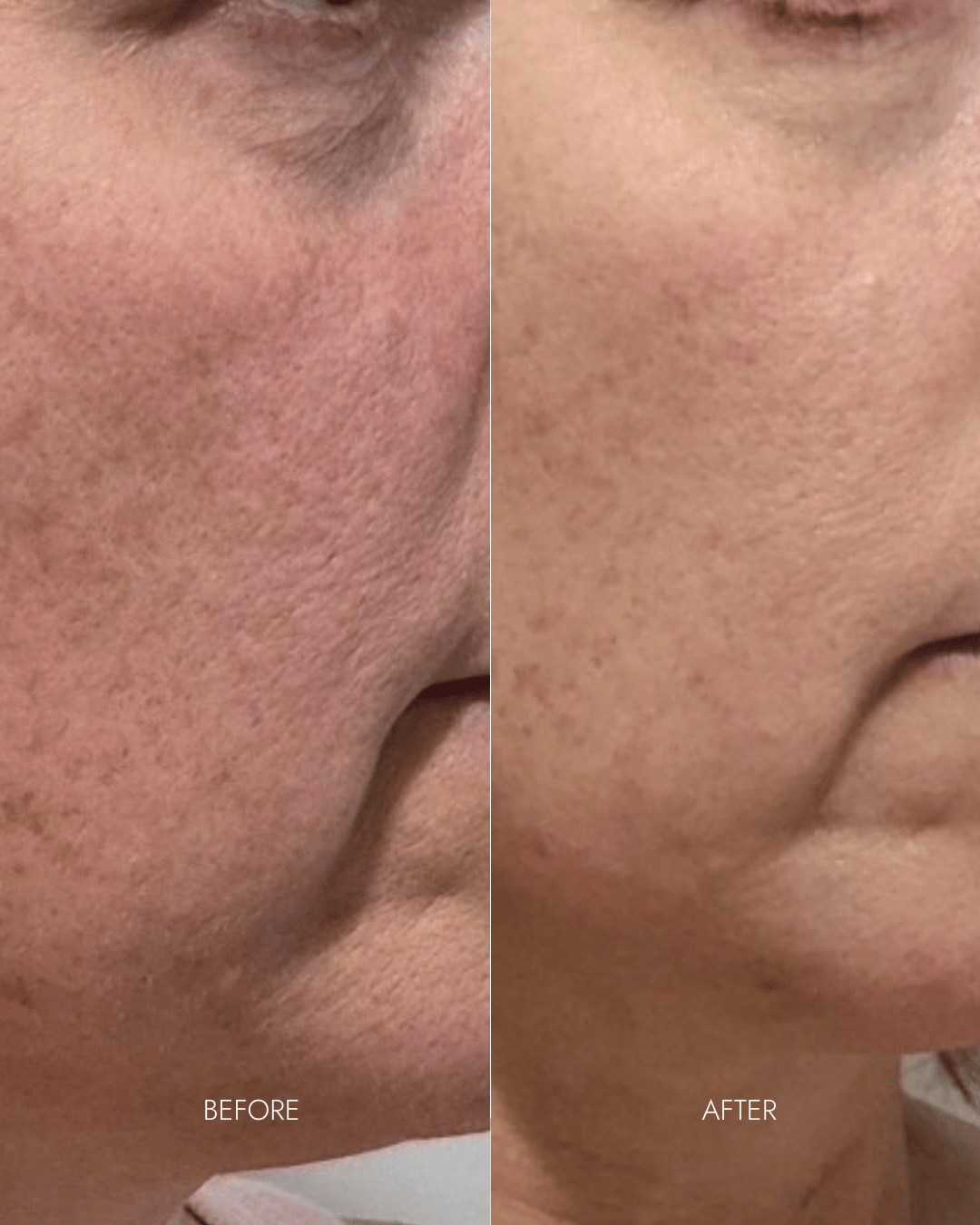 Youth Restore LED Therapy Mask