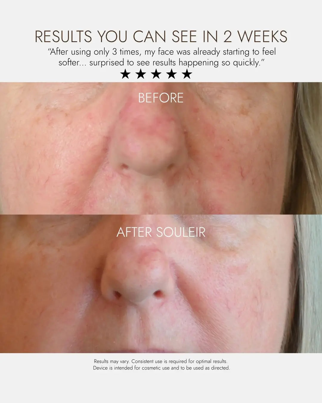 Ultimate Radiance Bundle: LED & Hydrating Serum