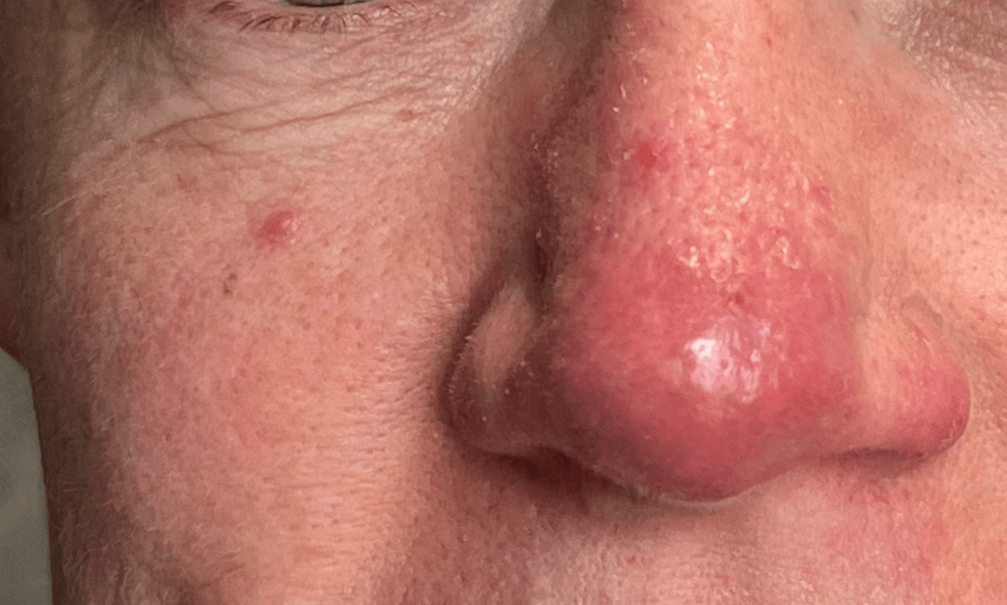 led face mask reviews