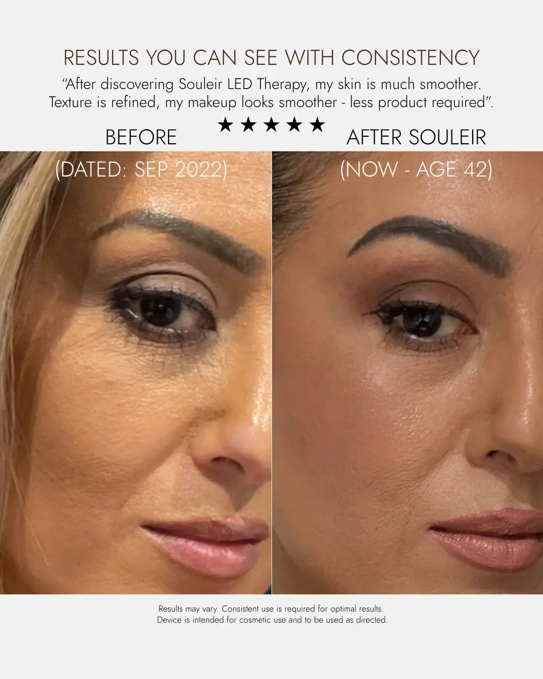 Ultimate Radiance Bundle: LED & Hydrating Regenerative Serum