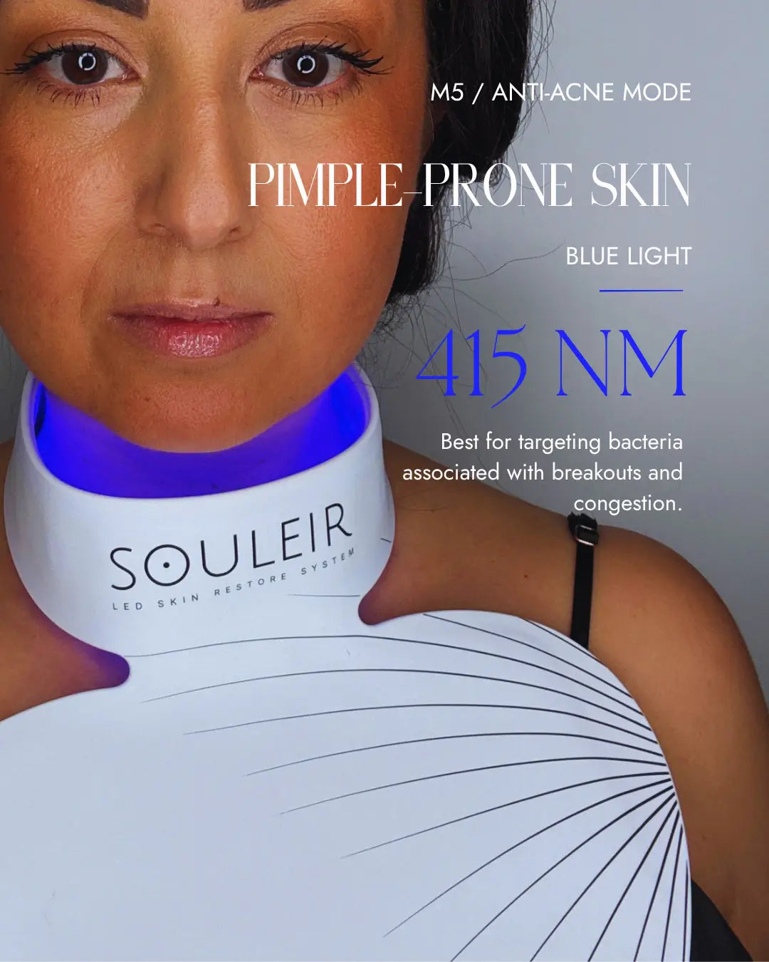 souleir anti-acne mode for pimple-prone skin