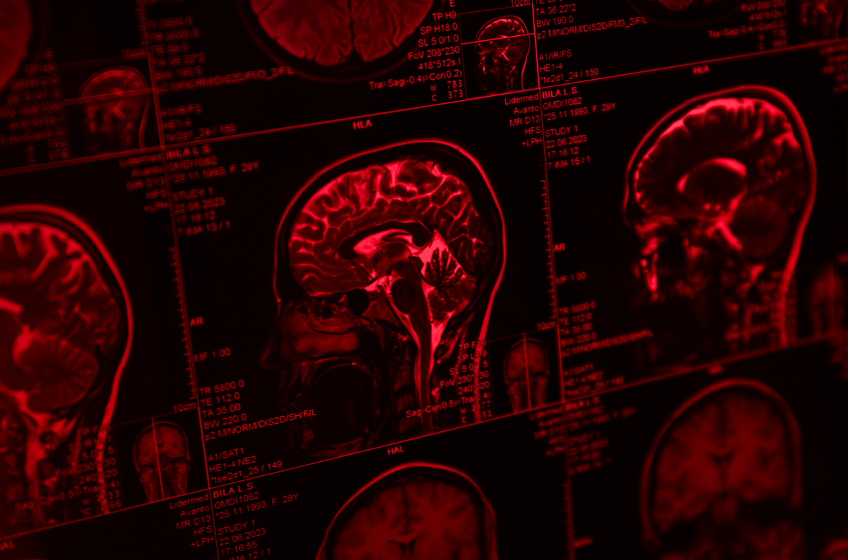 A Breakthrough for the Brain? The Surprising Link Between Red Light Th