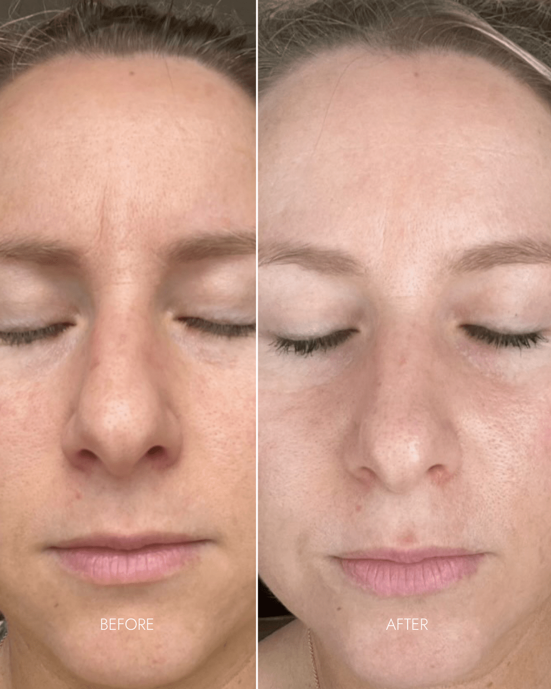 Youth Restore LED Therapy Mask